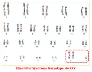 Karyotype Analysis Of Human Chromosome Easybiologyclass