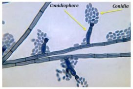 conidia-conidiophore-wikipedia | EasyBiologyClass