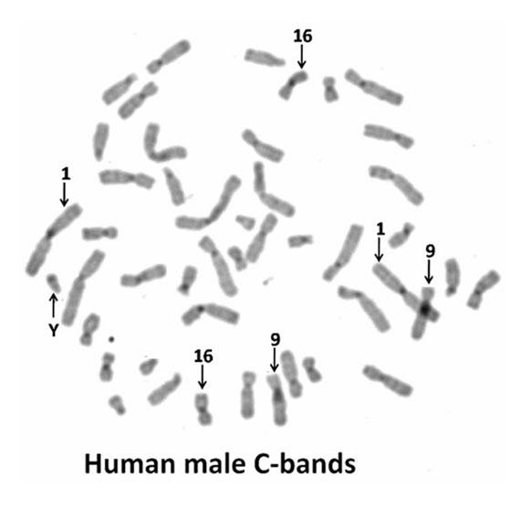 what is c banding in chromosome