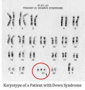 Chromosome Banding Techniques | EasyBiologyClass