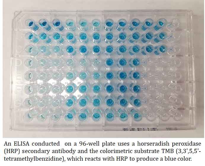 ELISA Short Notes | EasyBiologyClass