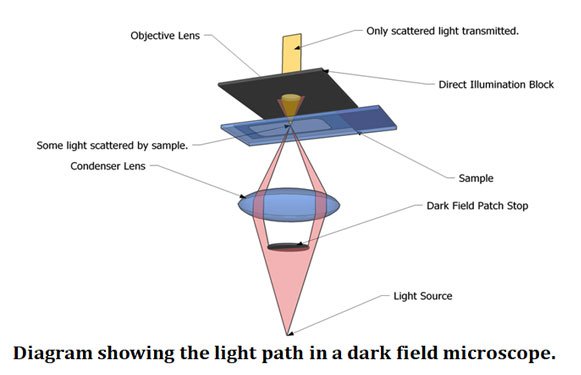 principles of dark field microscopy