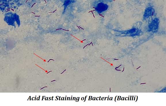 bacterial staining by acid fast