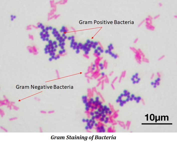 what is gram staining