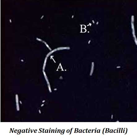 what is negative staining